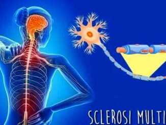 Sclerosi-multipla-nuova-storia-naturale-e-complessita-terapeutica-giornata-di-studio-a-Piacenza