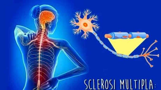 Sclerosi-multipla-nuova-storia-naturale-e-complessita-terapeutica-giornata-di-studio-a-Piacenza